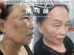 妈妈美白蚌埠是私人的吗—妈妈美白蚌埠是私人的吗？