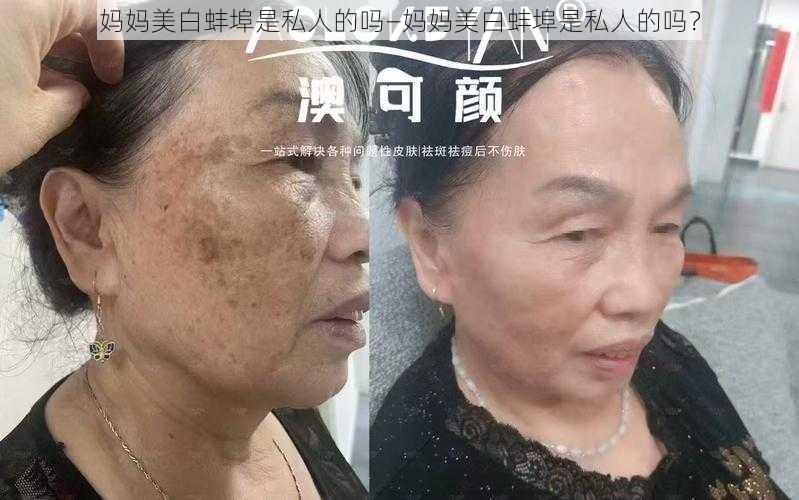 妈妈美白蚌埠是私人的吗—妈妈美白蚌埠是私人的吗？