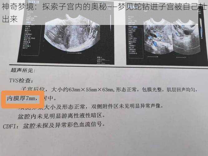 神奇梦境：探索子宫内的奥秘——梦见蛇钻进子宫被自己扯出来